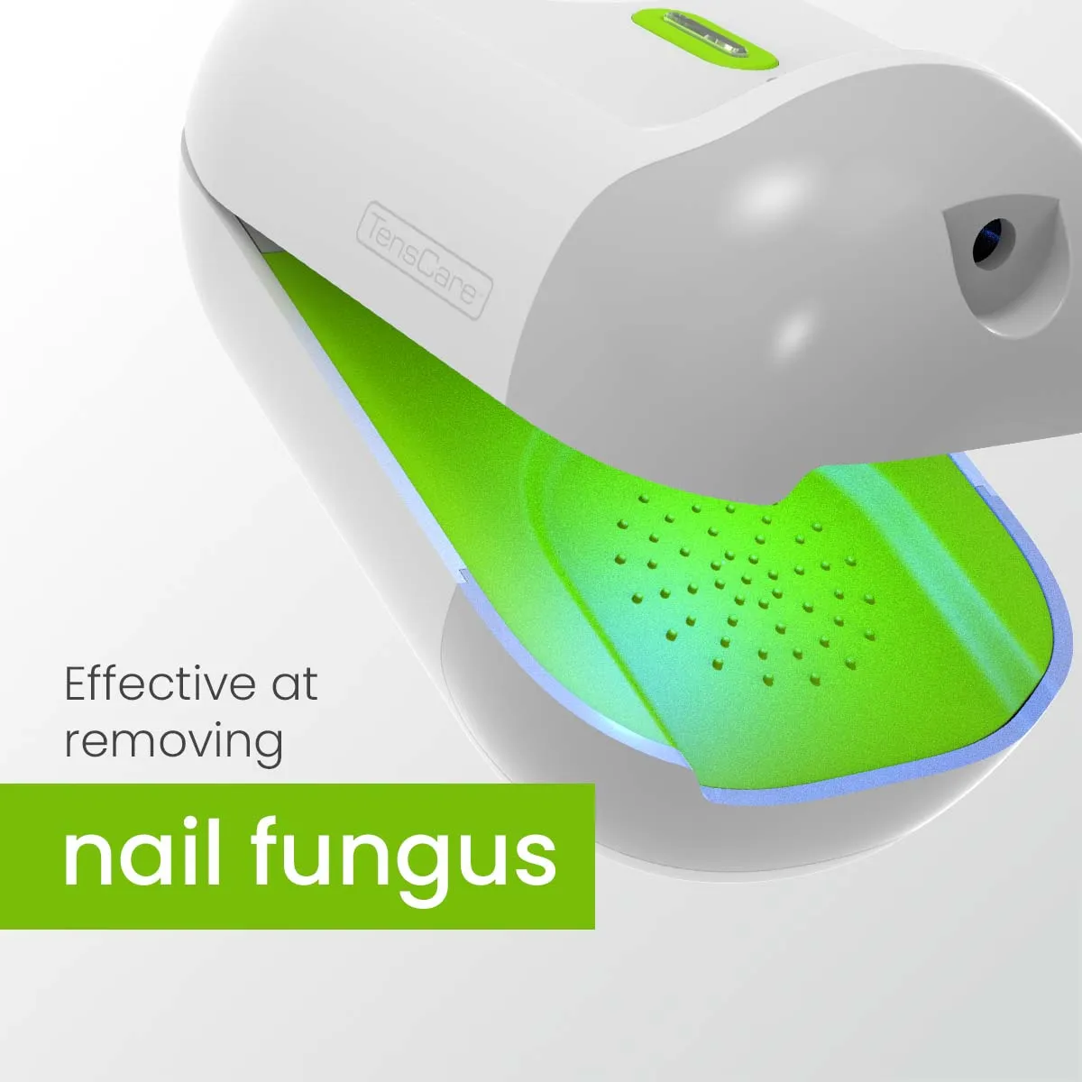 TensCare Nailit συσκευή laser νυχιών μυκήτων