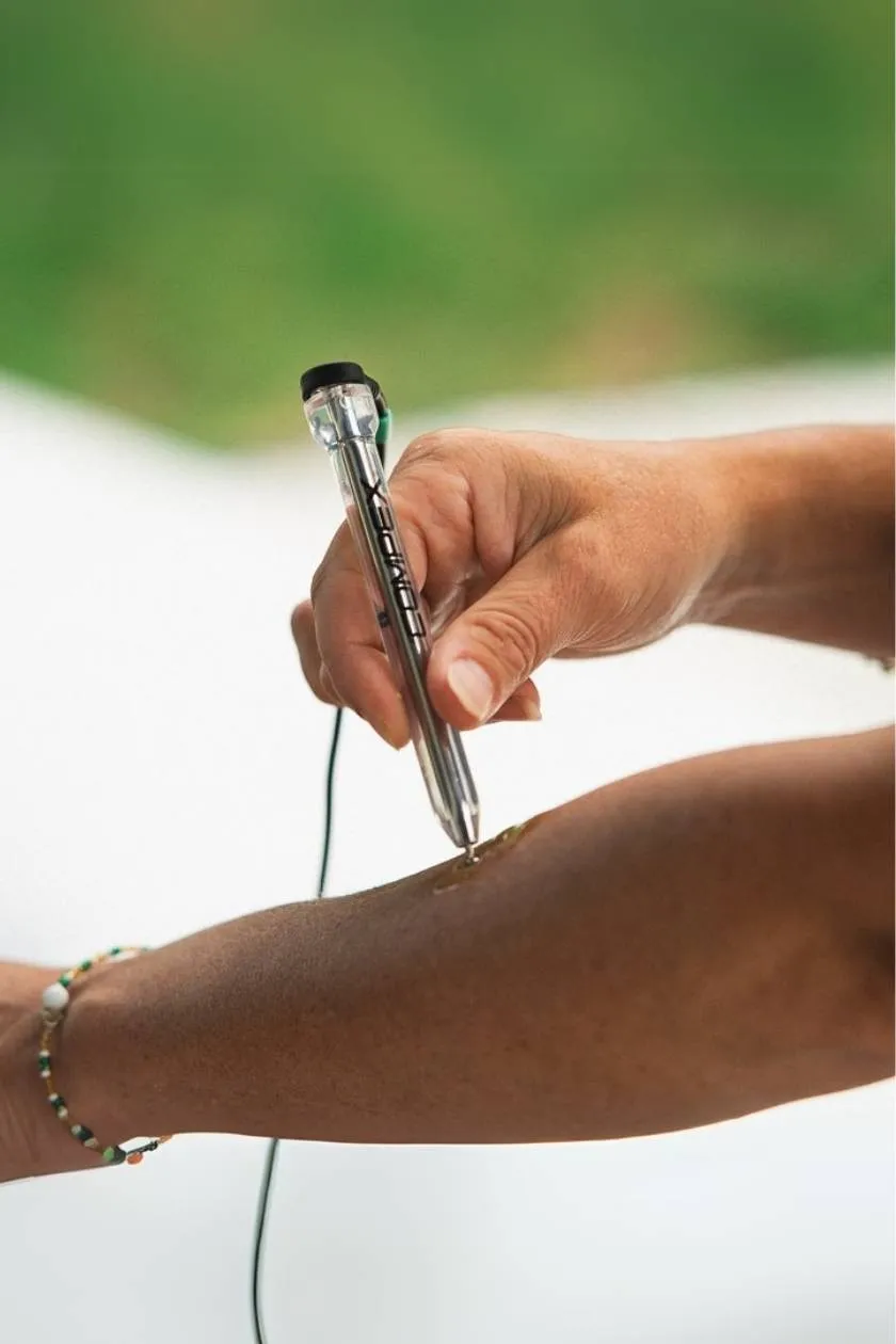 Compex Motor Point στυλό εντοπισμού με gel ηλεκτροδίων